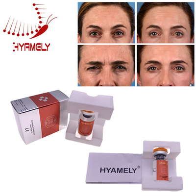 Injection botulinum de toxine de Hyamely Botox de matériaux de la Corée pour les rides faciales