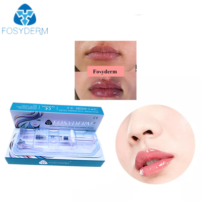 Remplisseur cutané d'acide hyaluronique transparent de gel pour la lèvre 24mg/Ml de visage