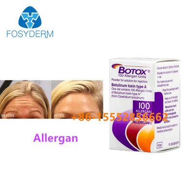 100 unités de toxine botulique Allergène pour éliminer les rides du visage Injection de Botox de type A