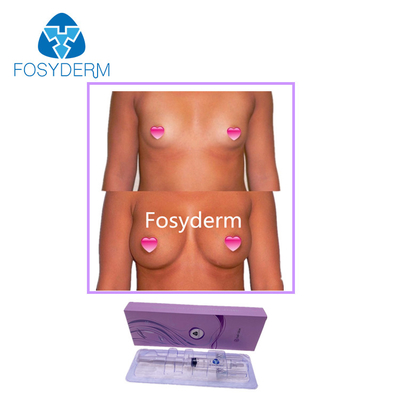 Remplisseurs cutanés fesses d'acide hyaluronique de Fosyderm 10ml et injection d'élargissement de sein