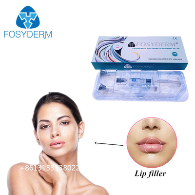 Fosyderm 1 ml d'acide hyaluronique Injections de remplissage cutané pour augmenter la taille des lèvres