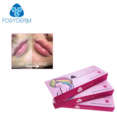 Fosyderm 1 ml d'acide hyaluronique Injections de remplissage cutané pour augmenter la taille des lèvres