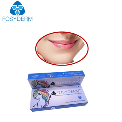 Remplisseur cutané d'acide hyaluronique de Fosyderm pour la plénitude de lèvres ligne profonde de 2 ml