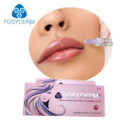 Joue de suffisance de lèvre soulevant le remplisseur cutané facial Fosyderm injectable 2ml d'ha