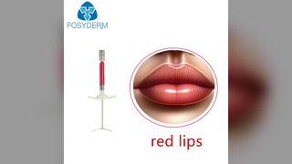 lèvres rouges