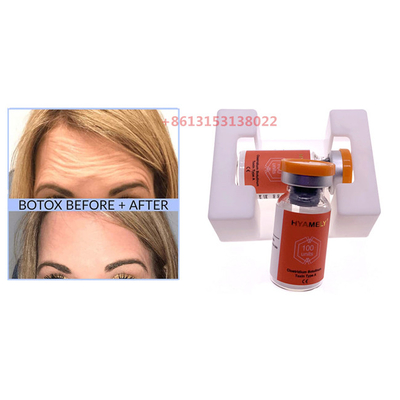 Rides de toxine de  de Hyamely anti de Botulax d'injection botulinum de poudre