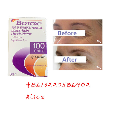 La toxine botulinum Allergan d'anti ride anti-vieillissement dactylographient une poudre de Botox