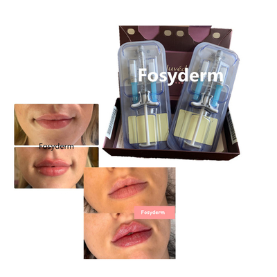 La croix de remplisseur de lèvres d'acide hyaluronique de volbella de Juvederm a lié 24mg