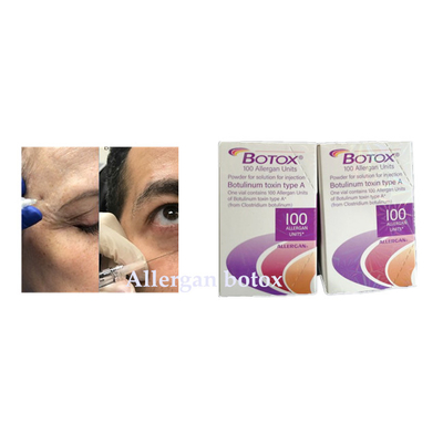 L'injection botulinum d'Allergan  de toxine pour la ride enlèvent