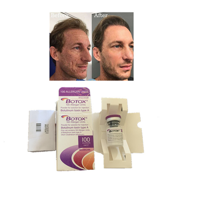 Allergan  100 Unités Types Injection de Toxine Botulique Anti Rides