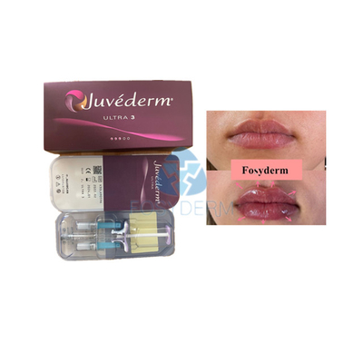 Remplisseur cutané d'acide hyaluronique de Voluma Fosyderm pour l'amélioration de lèvre