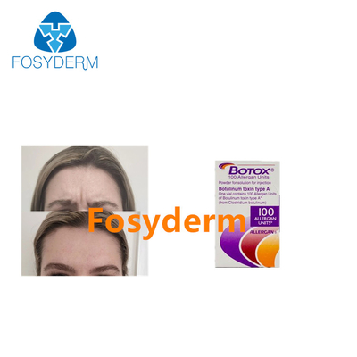 Les injections de toxine botulique Allergan éliminent les rides 100 unités