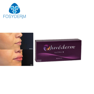 La croix de Juvederm Ultra3 2ml a lié l'injection cutanée d'acide hyaluronique de remplisseur de lèvres