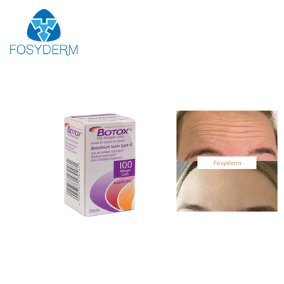 100Units Allergan Toxion botulinum pour enlèvent le type facial A de  de rides