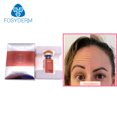 100 unités dactylographient une toxine botulinum Allergan que l'anti massage facial ride l'injection de  Botulax
