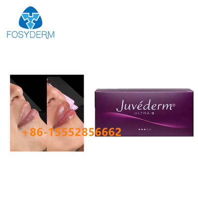 injection d'acide hyaluronique liée par croix cutanée de remplisseur de Juvederm d'amélioration de la lèvre 2x1ml