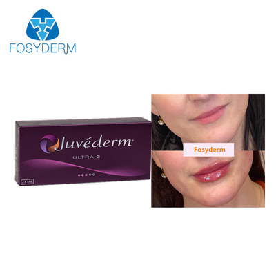 Injection liée croisée d'acide hyaluronique de remplisseurs cutanés de lèvre de Juvederm 2*1ml pour anti-vieillissement