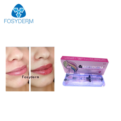Ligne cutanée de Derm d'injection d'amélioration de lèvre d'acide hyaluronique de remplisseurs de lèvre de Fosyderm 2ml