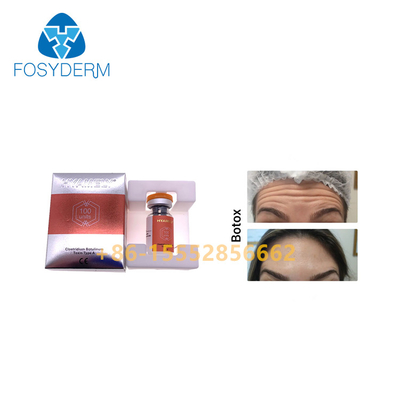 rides  Allergan d'injection botulinum de toxine de 100units TypeA anti