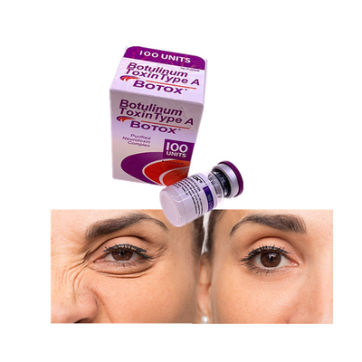 L'élimination du massage facial raye les unités botulinum Allergan Botoxo de la toxine 100