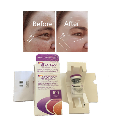 Réduction des rides 100 Unités Allergan  Injection élimine les lignes fines du visage