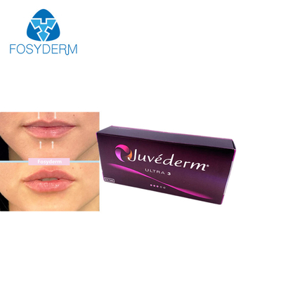 Juvederm 2*1ml Acide hyaluronique Remplisseur cutané Augmentation des lèvres Augmentation du menton