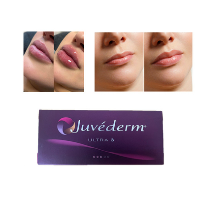 Juvederm Acide hyaluronique Remplisseur cutané anti-rides Remplisseur de lèvre facial