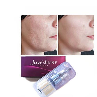 Juvederm Acide hyaluronique Remplisseur cutané anti-âge 2*1ml Remplisseur facial