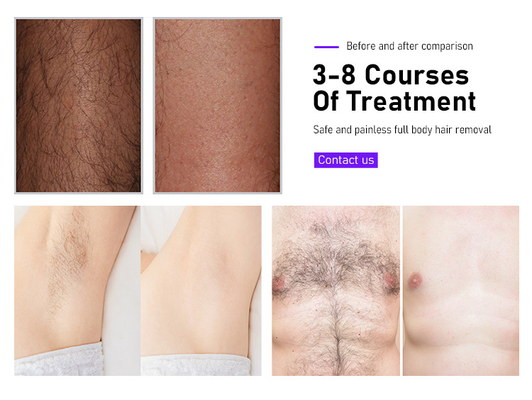 Équipement de beauté Fosyderm Laser épilateur 3 ondes 12 barres