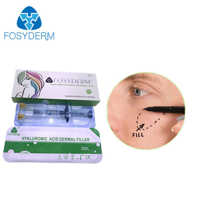 Fosyderm Deep 2ml Remplisseur cutané pour le rajeunissement du visage HA Remplisseur