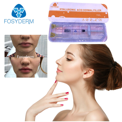 2 ml de remplissage cutané à l' acide hyaluronique pour lisser les rides sur le visage, le menton, les joues et le corps