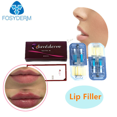 2 ml de remplissage cutané à l' acide hyaluronique JUVEDERM Gel injectable pour remplir les rides