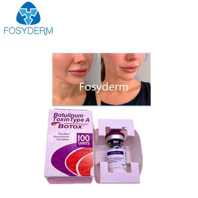 Type A 100 Unités Allergène Toxine Botulinique Remplisseur Dermique Acide Hyaluronique