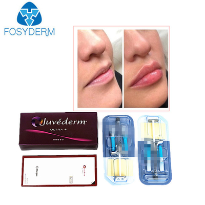 Juvederm Acide hyaluronique Remplisseur cutané anti-rides Injection pour le visage