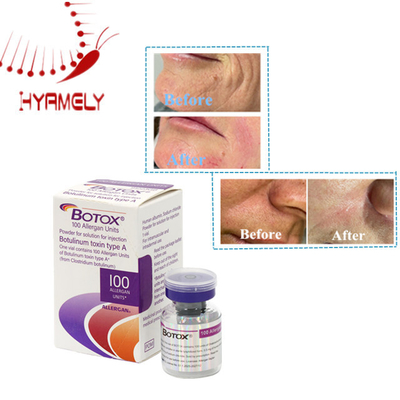 Soins efficaces de la peau Toxine botulique 100 unités Poudre d'allergène injectable