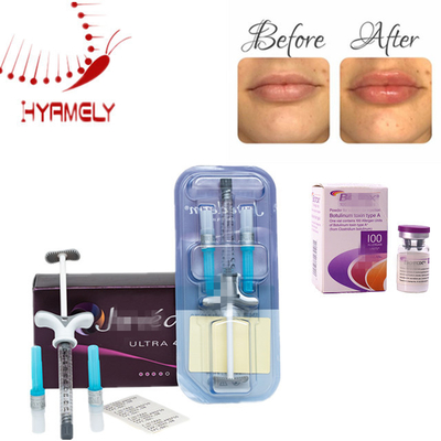 Injection d'Allergan à la toxine botulique, agent anti-rides, produit de comblement dermique pour la réduction des rides du visage et du cou