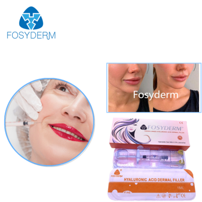 Produit de comblement dermique à l'acide hyaluronique 24mg/ml pour le visage, les lèvres, les joues et le menton
