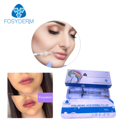 Produit de comblement dermique à l'acide hyaluronique 24mg/ml pour le visage, les lèvres, les joues et le menton