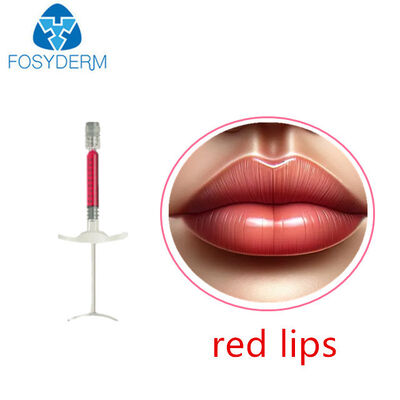 Volume des lèvres avec vitamine B12 1 ml 24 mg/ml de remplissage cutané acide hyaluronique rouge à lèvres