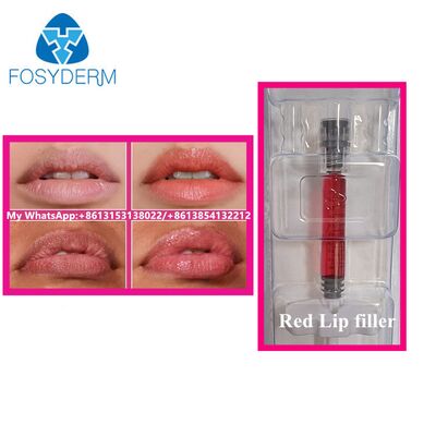 Remplisseur de lèvres rouges avec vitamine B12 Acide hyaluronique injectable Remplisseur de beauté élargissement des lèvres 1 ml