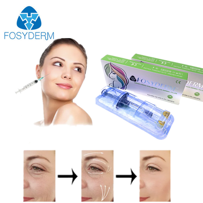 Produit de comblement dermique à l'acide hyaluronique pour le rajeunissement du visage, le menton, les joues, les lèvres, le corps, les fesses