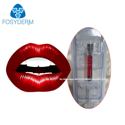 Produit de comblement des lèvres rouge à base d'acide hyaluronique avec vitamine B12 pour les lèvres 1 ml