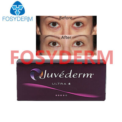 Juvederm Hyaluronic Acid Dermal Filler pour le lifting des lèvres et du visage 24 mg