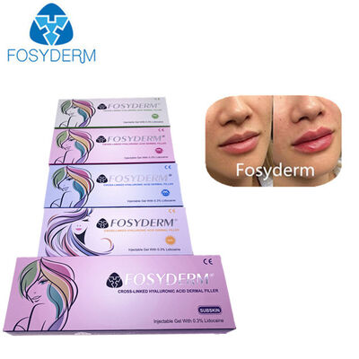 Acide hyaluronique dermal filler anti-rides lifting facial 1ml 2ml