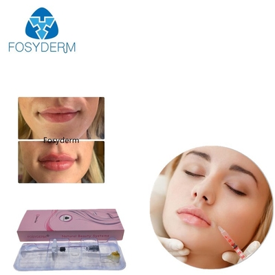 Gélifiez Fosyderm 2ml croisent le remplisseur cutané lié d'acide hyaluronique pour l'amélioration de lèvre