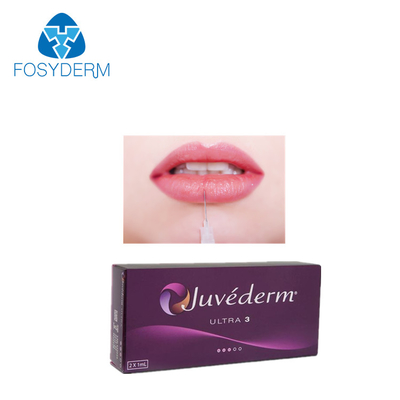 Lèvre Juvederm remplisseur cutané 2*1ml d'ultra 3 acides hyaluroniques