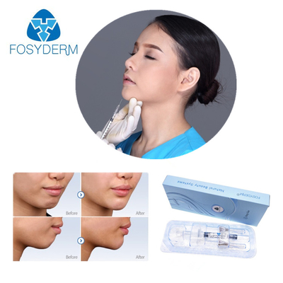 Injection de gel d'acide hyaluronique de remplisseur de lèvre de Fosyderm Hyafilia 2ml
