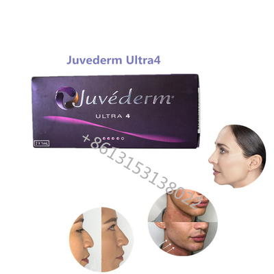Remplisseurs cutanés de Juvederm ha de remplisseur de Juvederm Ultra4 Allergan de plénitude de lèvre pour des lèvres