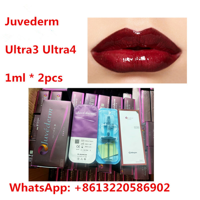 Remplisseur cutané d'ha de lèvre de Juvederm avec du lidocaïne Ultra3 Ultra4