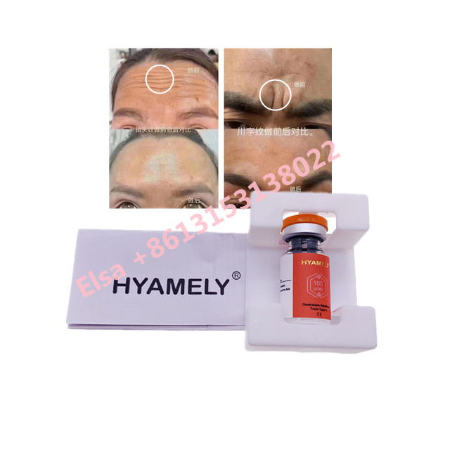 Toxine botulinum de Hyamely  dactylographier un cosmétique coréen de  100u